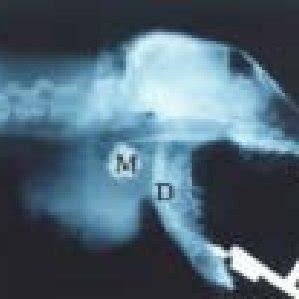 Normal parotid (P) sialogram in a | Download Scientific Diagram