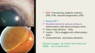 Episcleritis & Scleritis (causes, clinical features, treatment).pptx