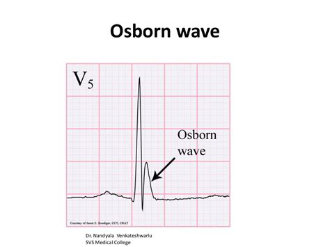 Osborn wave venkat ppt