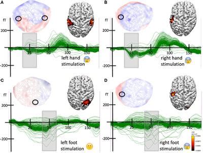 Frontiers | Somatosensory Misrepresentation Associated with Chronic Pain: Spatiotemporal ...