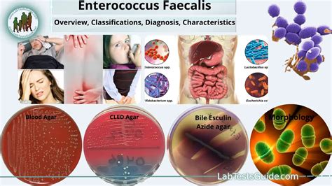 Enterococcus faecalis: Overview, Symptoms, Diagnosis, Treatment and more