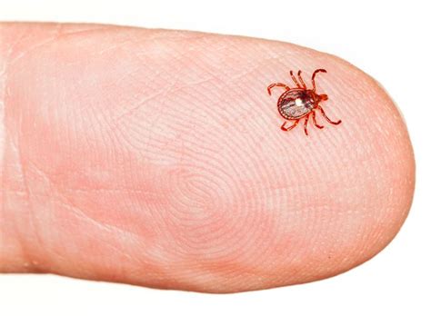 Red Meat Allergy From Tick Bites Increasing – Best Allergy Sites