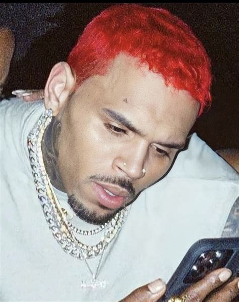 Chris Brown Hair Transplant: Did He Really Get It?