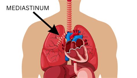 Mediastinum – Institute of Chest Surgery