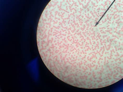 Red blood cells seen through a microscope at 400x magnification (iPhone quality) : mildlyinteresting