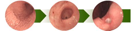 GI Endoscopy Centre