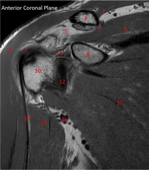 Shoulder MRI Anterior Coronal Plane Diagram | Quizlet