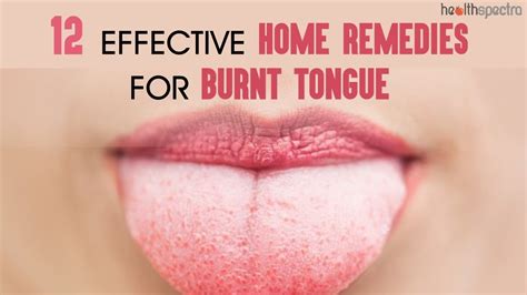 12 Effective Home Remedies For Burnt Tongue | Healthspectra - YouTube