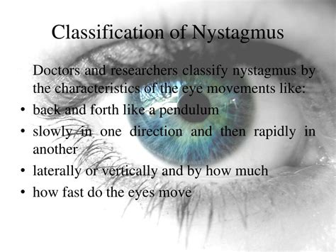 PPT - Nystagmus PowerPoint Presentation, free download - ID:1852222