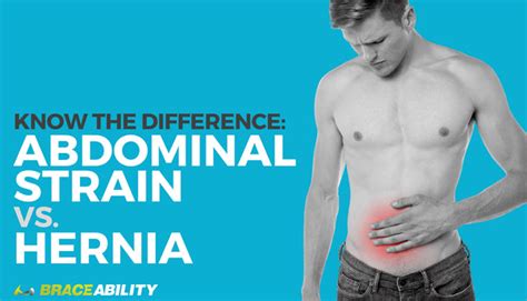 Know The Difference: Abdominal Strain vs. Hernia