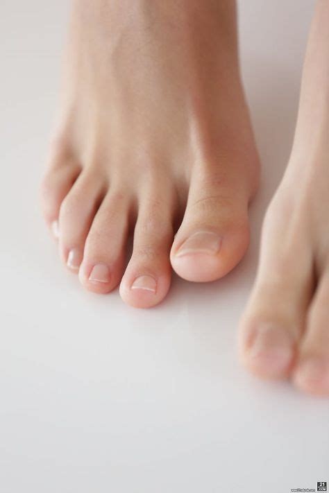 60 Best Morton's Toe images in 2020 | Morton's toe, Big toe, Toe polish