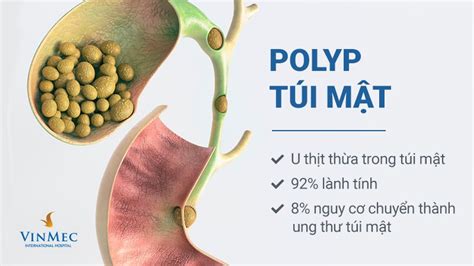 Gallbladder polyp, abdominal distension with lower costal pain, what to ...