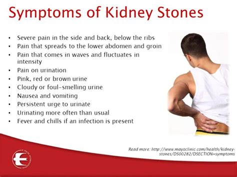What are the symptoms of kidney stones? | Timeslifestyle