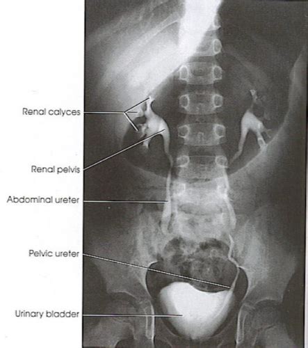 URINARY SYSTEM PART 4 (radiographic procedures) Flashcards | Quizlet