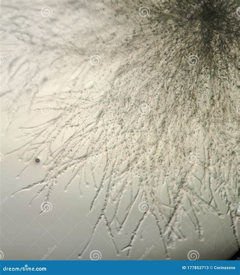 Fusarium Oxysporum Under the Microscope Stock Image - Image of biology, view: 177853713