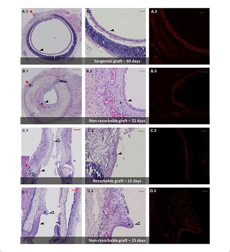 Graft histology and immunofluorescence. (A.1-A.2). Low and high... | Download Scientific Diagram