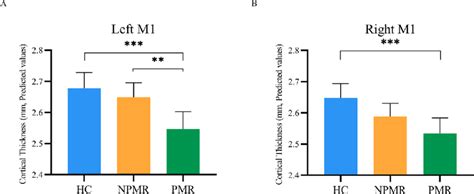 Cortical thickness of the bilateral M1. (A) and (B) shows cortical... | Download Scientific Diagram