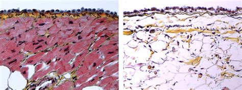 e-heart.org Cardiovascular Pathology Home Page