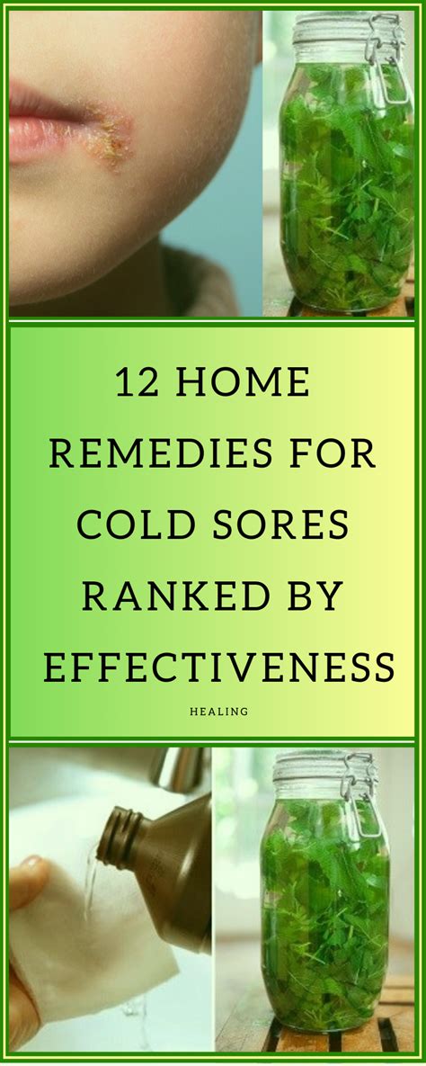 12 Home Remedies For Cold Sores Ranked By Effectiveness | Home Remedies | Cold home remedies ...