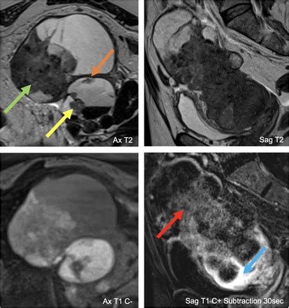 Rads Charts For Imaging