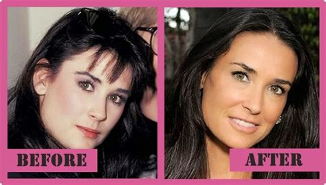 Demi Moore Plastic Surgery - Rumor Or Has Gone Wrong