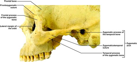 Zygomatic Arkadium