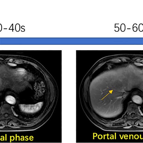 Workflow of multi-phase contrast-enhanced MRI technique. | Download ...