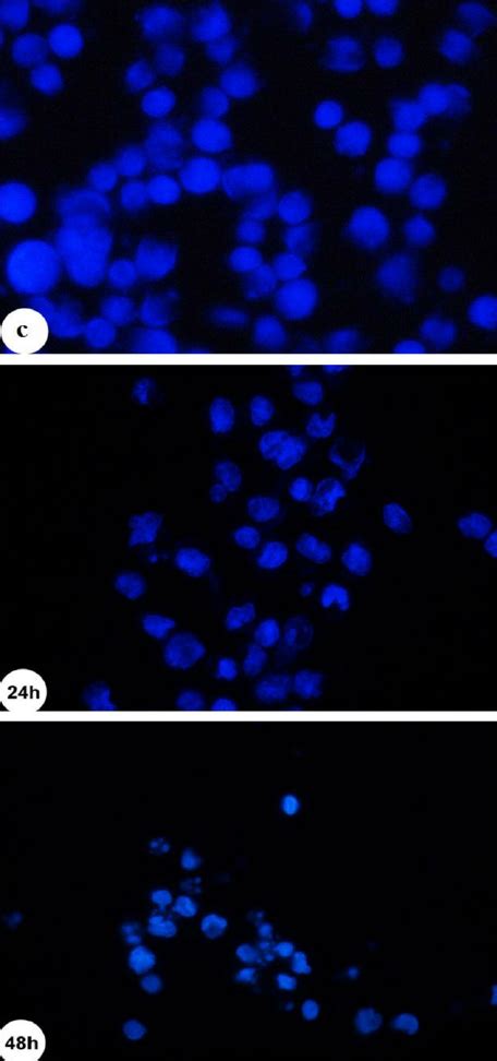 Hoechst staining shows apoptotic bodies and necrotic cell death due to... | Download Scientific ...