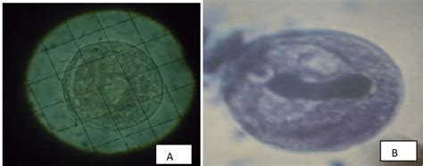 Forms of Balantidium coli cysts observed. Round cyst 30 µm (A) and 40 µ ...