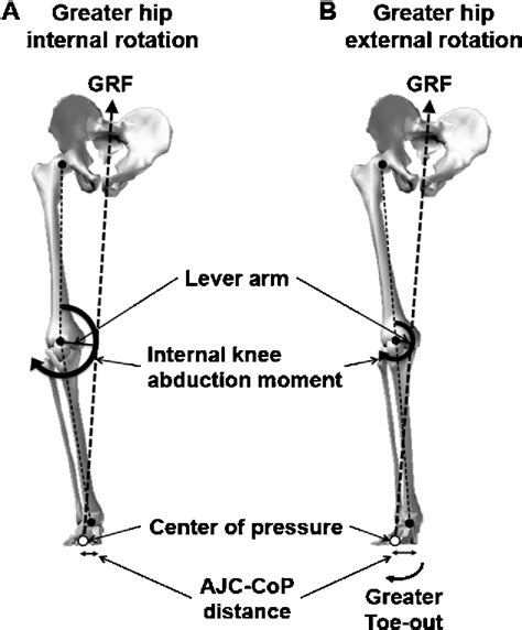 Table 1 from Hip rotation angle is associated with frontal plane knee joint mechanics during ...