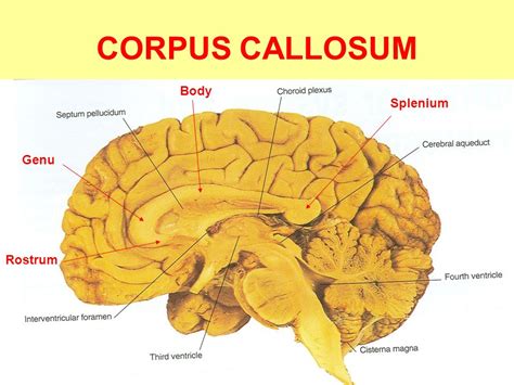 Corpus Callosum Anatomy Genu Rostrum