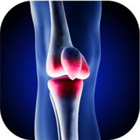 Arthroscopic Chondroplasty | Knee Surgery | ArlingtonOrthopedic |Texas | Knee Scopes | Pinterest ...