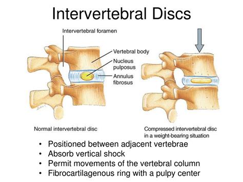 PPT - Lab05 Vertebrae Ribs and rib articulation Sternum Skull Review ...