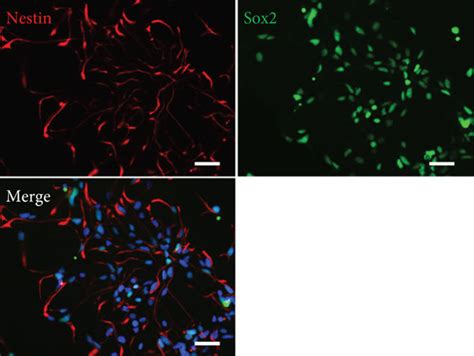 Neural induction of human ep-iPSCs into neural precursor cells. (a)... | Download Scientific Diagram