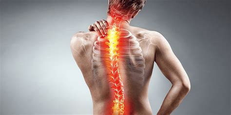 A Patient's Guide to Scoliosis Surgery | Advanced Spine Care