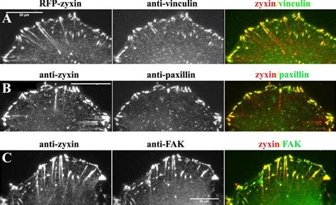 Differential behavior of focal adhesion proteins. The distribution of... | Download Scientific ...