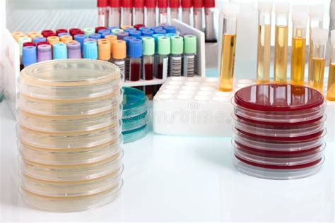 Biological Sample on the Workbench in the Microbiology Laboratory Stock ...