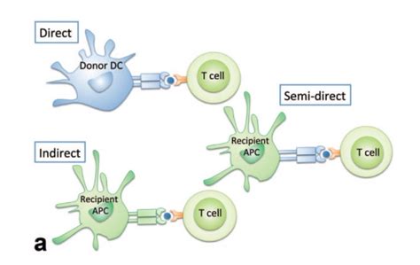 New Approaches in HLA Matching - PIRCHE - Omixon | NGS for HLA