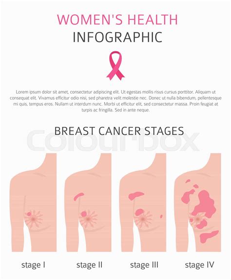 Breast cancer, medical infographic. Diagnostics, symptoms, treatment ...