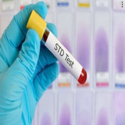 What Is An STD Clinic and Why You (Might) Need One?