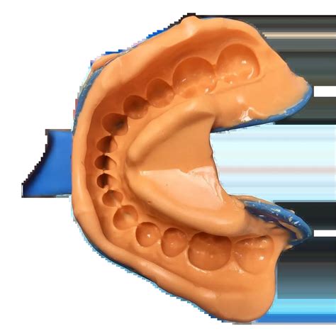 Yiwen Dental Impression Alginate - Buy Impression Alginate,Dental ...