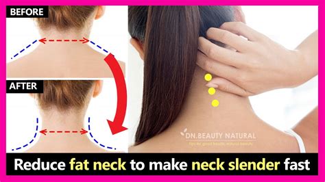 How To Reduce Neck Fat - Flatdisk24