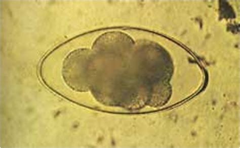 Nematodirus