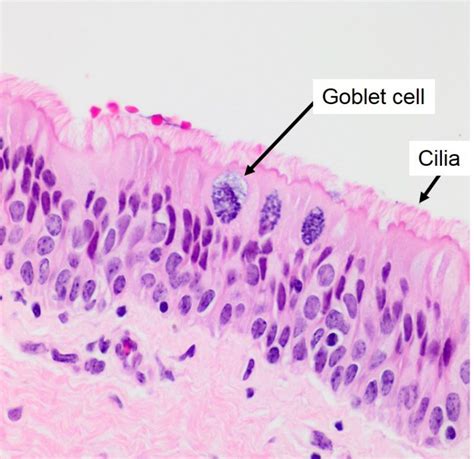 Conduzione dell'aria: Laringe, Trachea, Bronchi e Bronchioli - Istologia Veterinaria | St. Charles