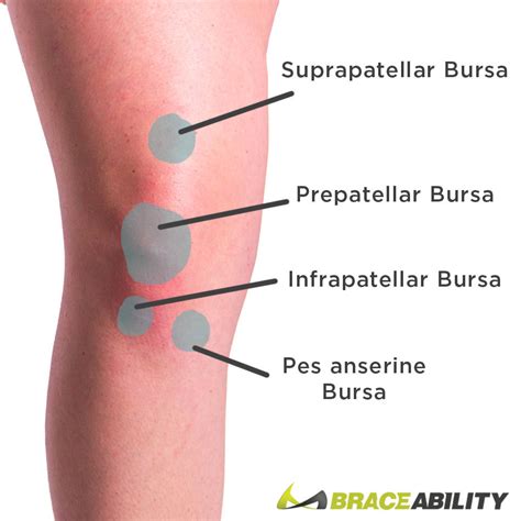 Knee Bursitis Treatment | Best Knee Braces for Pes Anserine Bursitis