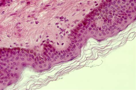 Stratified Squamous Epithelium Cartoon