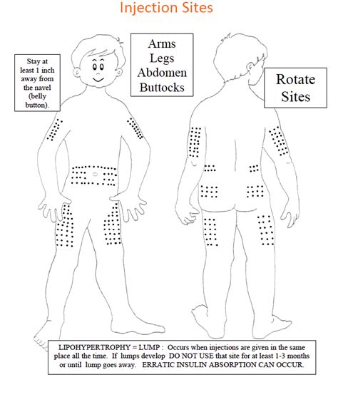 Printable Insulin Injection Site Rotation Chart