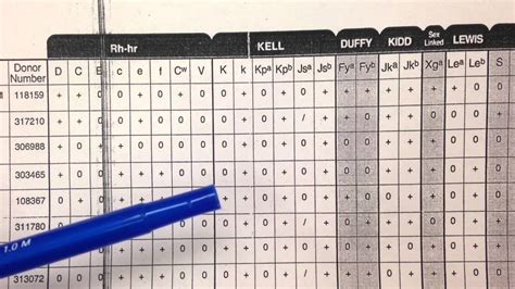 Blood Bank Antibody Chart: A Visual Reference of Charts | Chart Master