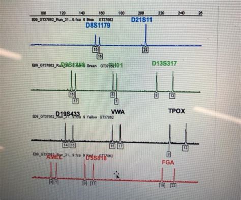 Electropherogram Interpretation The semen stain found | Chegg.com