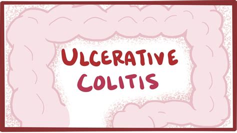 Ulcerative Colitis Treatment in Ayurveda-Diet & Home Remedies